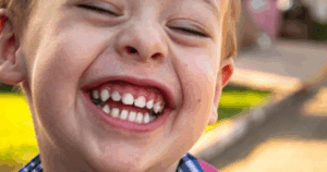 Pediatric Dentist VS. General Dentist: Who’s the Best for Your Child