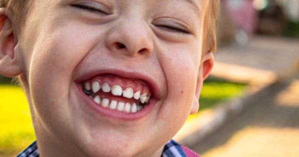 Pediatric Dentist VS. General Dentist: Who’s the Best for Your Child