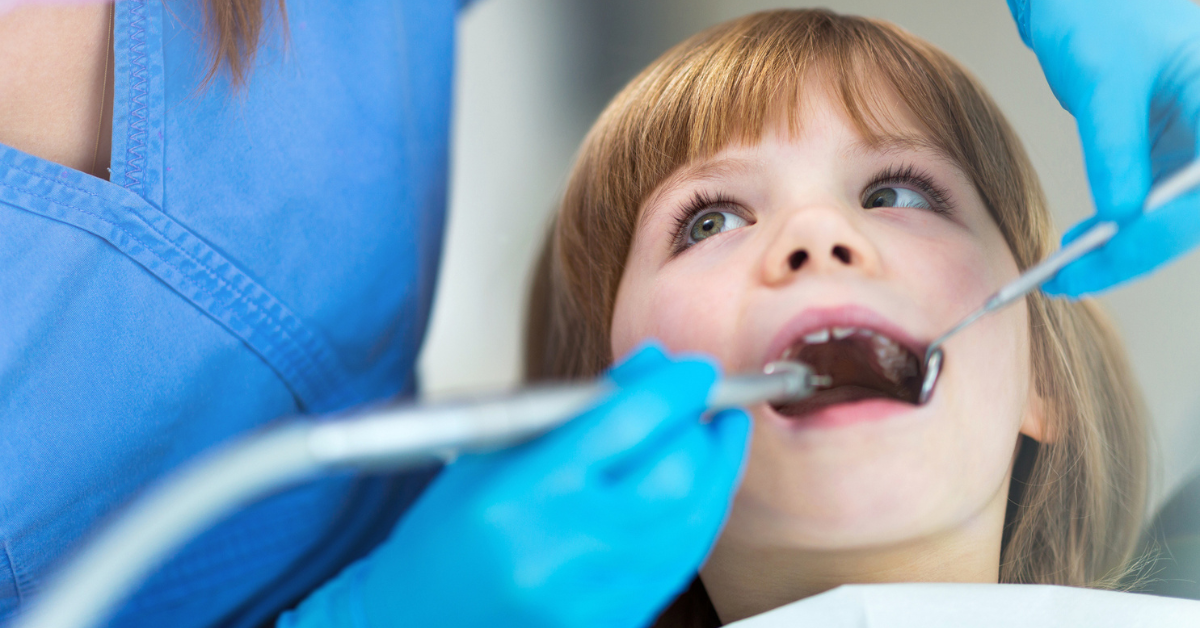 Silver Diamine Fluoride and Its Benefits in Pediatric Dentistry