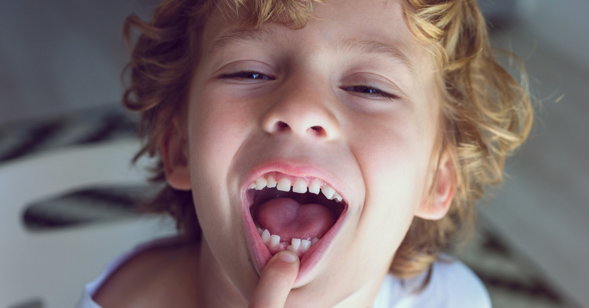When Do Kids Lose Their Baby Teeth?