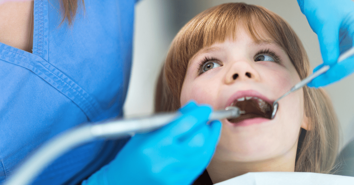Silver Diamine Fluoride and Its Benefits in Pediatric Dentistry